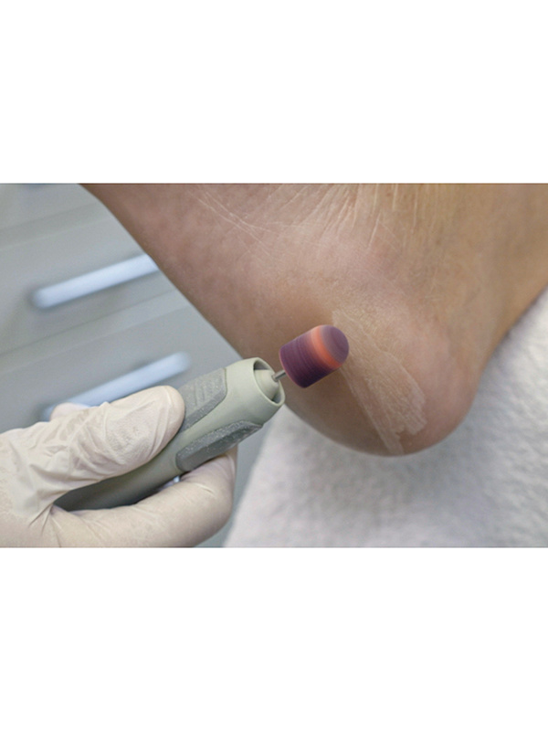 Thermo rullukan irtokärjet 10 mm 10 kpl - Image 2