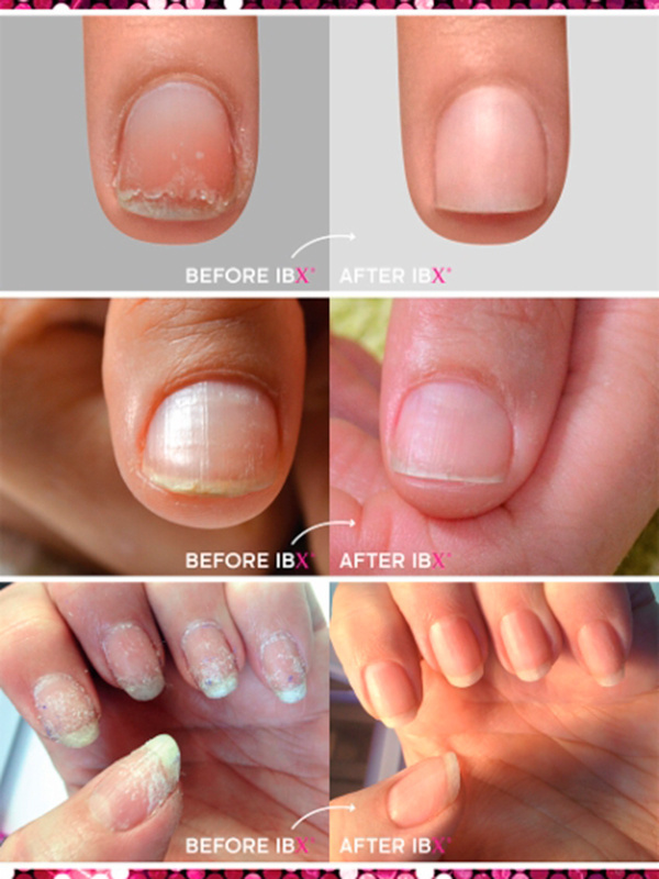 IBX Duo Pack - Image 2