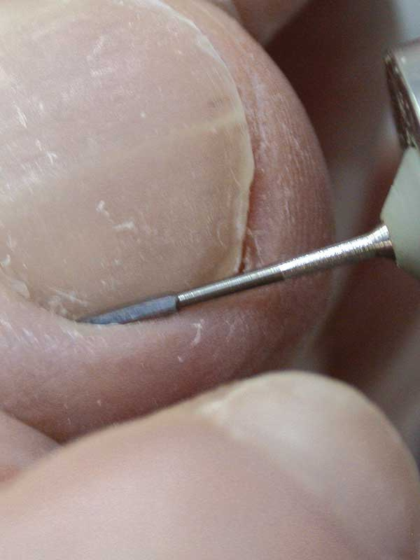 Ony-Clean poranterä, pitkä 2 kpl - Image 2