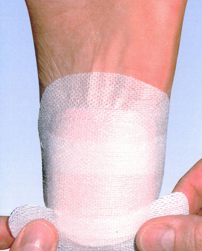 Chirofix -joustoteippi 10 cm x 10 m